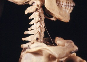 Color photograph of skeleton, lateral view, showing the cervical vertebrae