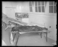 Full length view of Grace Young's body, laying on an autopsy table in coroner's office in Los Angeles, Calif., 1925