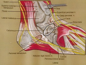 Illustration of dissection of the right ankle, lateral view, emphasizing the bones of the ankle joint and the related musculature and nerves, with the peroneal and extensor retinaculum cut and reflected