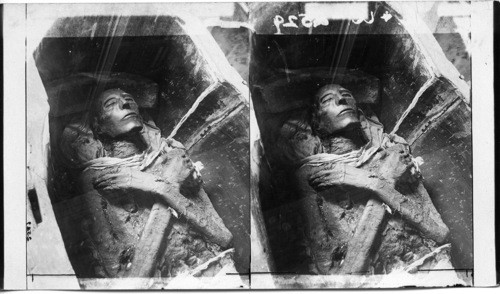 The Body of Sethos I, who Lived in the 14th Century, Cairo. Egypt