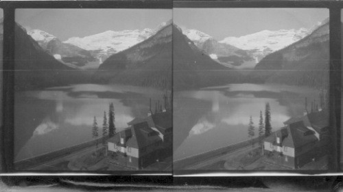 Lovely Lake Louise and the Hanging Glacier, Mt. Victoria. view from Chalet, Alberta, Canada