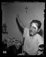 Father of witness displaying wounds from beating during State Senate hearing on narcotics trafficking in Los Angeles, Calif., 1955