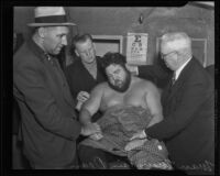 Wrestler Man Mountain Dean after his battle with Vincent Lopez, Los Angeles, 1936