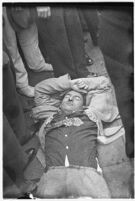 Unidentified young man injured during a workers' strike, Los Angeles, 1937