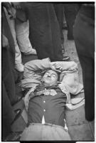 Unidentified young man injured during a workers' strike, Los Angeles, 1937