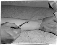 Honeybee stinging a patient's arm to treat arthritis in Dr. Raymond L. Carey's laboratory, Los Angeles, November 9, 1941