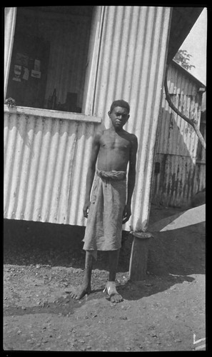 Cowa, one of Lambert's hookworm patients