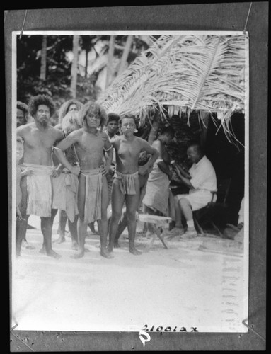 Anuta natives waiting for medical treatment