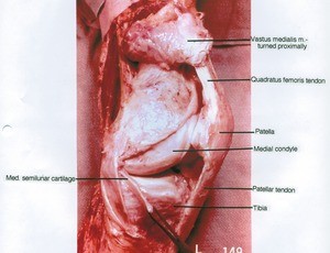 Natural color photograph of left knee, medial view, showing cartilage, muscle, tendons and bones with vastus medialis reflected