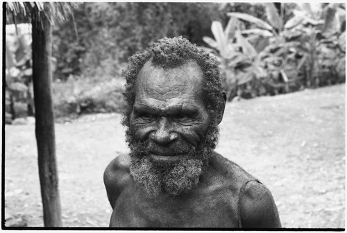 Fainjur: elderly man