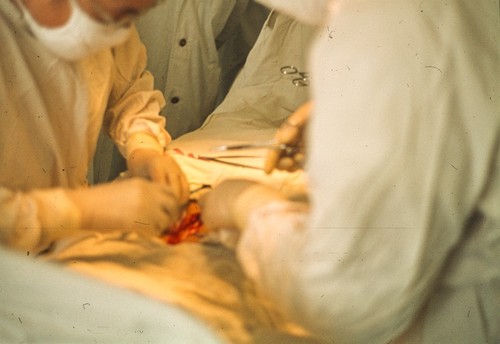 Surgery Using Acupuncture Anesthesia