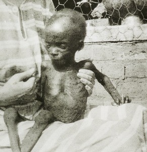 Emaciated child, Nigeria, ca. 1930