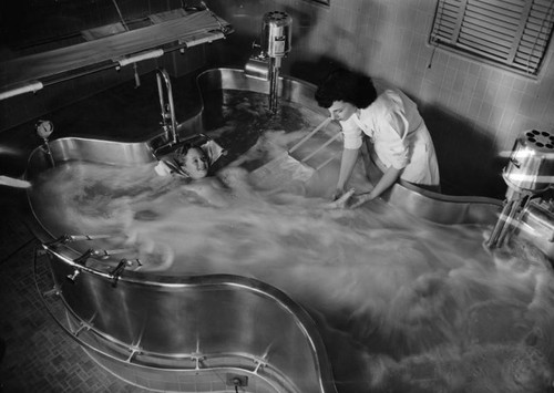 Polio whirlpool therapy