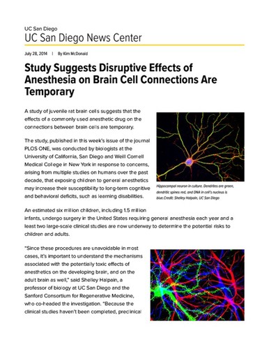 Study Suggests Disruptive Effects of Anesthesia on Brain Cell Connections Are Temporary