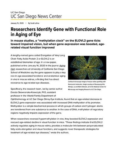 Researchers Identify Gene with Functional Role in Aging of Eye