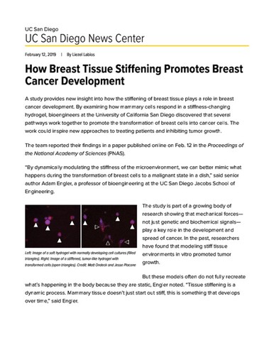 How Breast Tissue Stiffening Promotes Breast Cancer Development