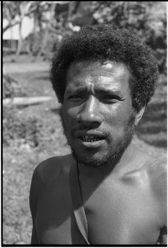 Man with betel nut stains on teeth