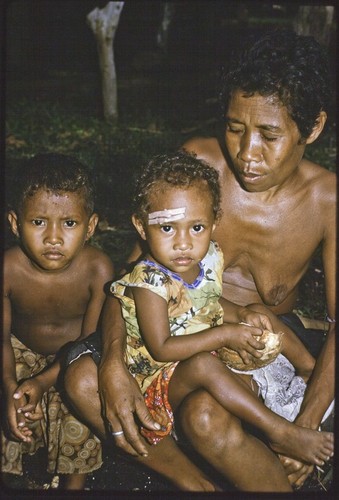 Child with bandaged forehead sits on a woman's lap, eating coconut