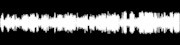 [Oral argument before the Supreme Court of California in Cedars-Sinai Medical Center v. Superior Court, no. S048596, February 11, 1998]