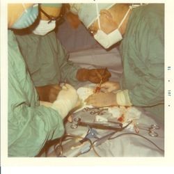 Dr. Meckel of old Palm Drive Hospital performing a diverticulum operation June 29, 1970