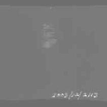 Negative, Safety, Unknown