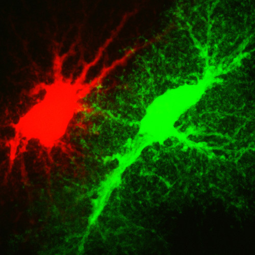 Microscopy product ID: 1007