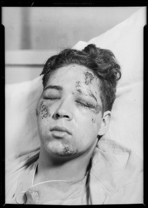 Injuries to Mr. Dias, Southern California, 1933