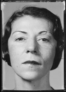 Mrs. T.C. Murphy to show scars on face, Southern California, 1934
