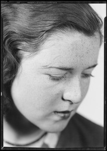 Girl with scar, Warburton Vs. Long, Southern California 1933