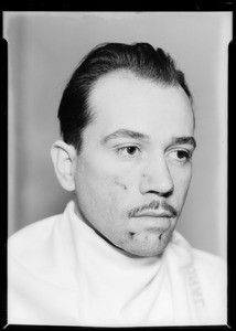 Man's face, woman's body (skin diseases), Southern California, 1933