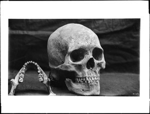 Male skull and teeth of Indian cliff dwellers, 1895