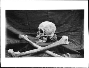 Female skull and leg bones of Indian cliff dwellers, 1895