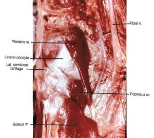 Natural color photograph of lateral aspect of knee, posterior view, showing muscles, nerve and cartilage