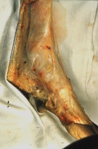 Natural color photograph of dissection of the right ankle, lateral view