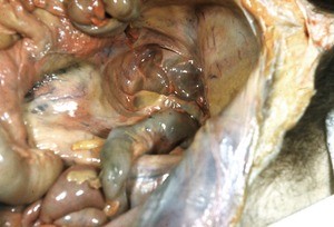 Natural color photograph of dissection of the floor of the peritoneal cavity, anterior-superior view