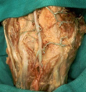 Natural color photograph of the knee, posterior view, showing the popliteal artery