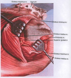 Illustration of dissection of the left gluteal region, posterior view