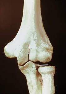 Bones of the elbow, anterior view, including the humerus, the radius and the ulna