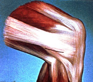 Illustration of right knee in flexion, from lateral aspect; black line on distal iliotibial tract