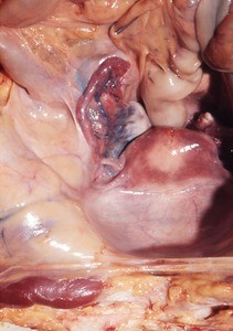 Natural color photograph of dissection of the pelvic cavity, superior view, showing the pelvic organs and associated viscera