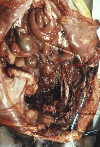 Natural color photograph of dissection of the abdomen, anterior view, showing the internal organs