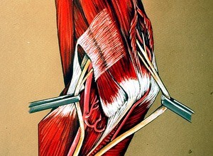 Illustration of right cubital fossa, anteromedial aspect, showing neurovascular bundle in relation to the bicipital aponeurosis, ulnar nerve in relation to medial epicondyle of humerus and flexor muscle group