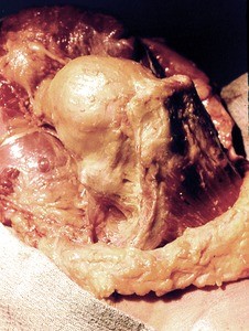 Natural color photograph of dissection of the right shoulder, medial view, showing bones and muscles of the glenohumeral joint