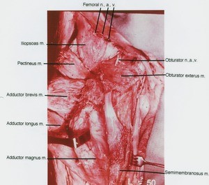 Natural color photograph of dissection of the right thigh, anteromedial view