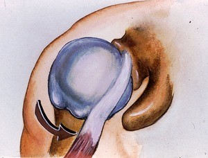 Illustration of dissected right gleno-humeral joint in medial (internal) rotation (see large arrow); anterior view