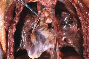 Natural color photograph of dissection of the thorax, anterior view, with the rib cage removed and and pericardium opened to reveal the heart and severed aorta