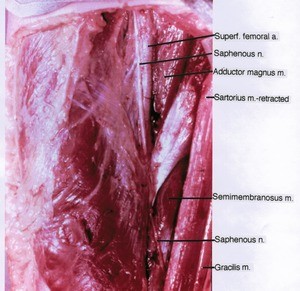 Natural color photograph of mid right thigh, anteromedial view, showing artery, muscles and the course of Saphenous nerve, with the Sartorius muscle retracted