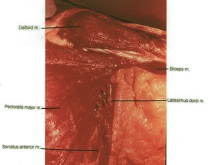 Natural color photograph of dissection of the left axillary region, anterior view, showing the significant musculature