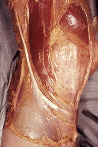 Natural color photograph of dissection of the left knee, medial view, showing muscles and tendons