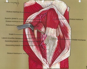 Illustration of right hip joint, lateral view, showing muscles, nerve, artery and bone with gluteus maximus retracted